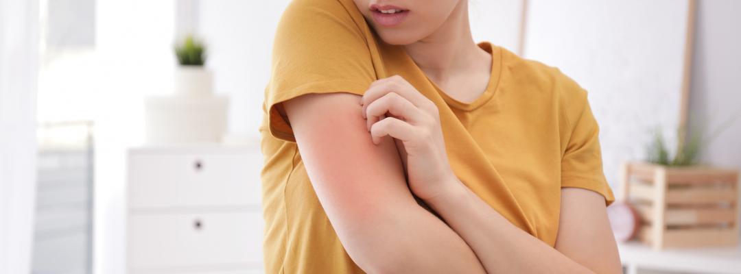 Allergie, Hautausschlag
