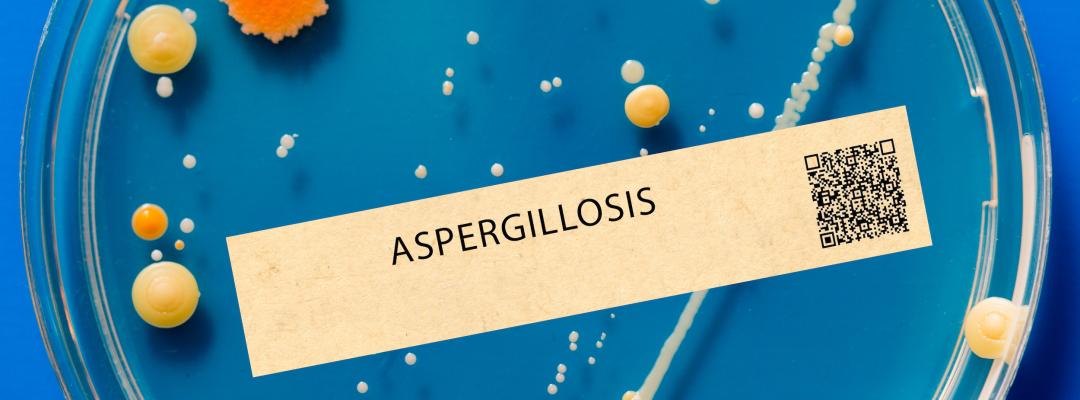 Pilzinfektion Aspergillose