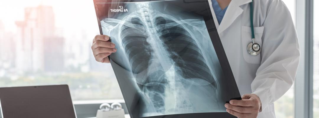 Ärztin diagnostiziert Asthma, Lungenerkrankung, COPD oder Knochenkrebs-Erkrankung mit radiologischem Röntgenfilm zur Brustdiagnostik für medizinische Krankenhausversorgung