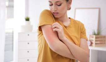Allergie, Hautausschlag