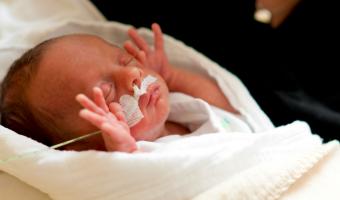 Bronchopulmonale Dysplasie