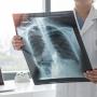 Ärztin diagnostiziert Asthma, Lungenerkrankung, COPD oder Knochenkrebs-Erkrankung mit radiologischem Röntgenfilm zur Brustdiagnostik für medizinische Krankenhausversorgung